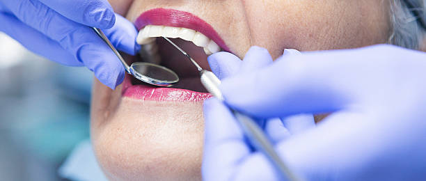 Best Pediatric Emergency Dentist in Al Creek, CO